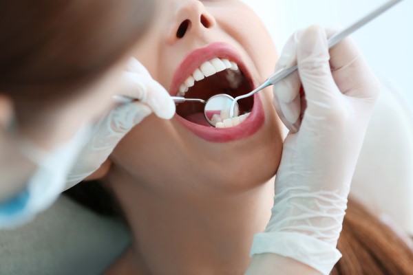 How Often Should You Get A Teeth Cleaning?