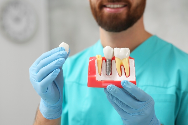 Implant Dentistry FAQs About Multiple Tooth Replacement